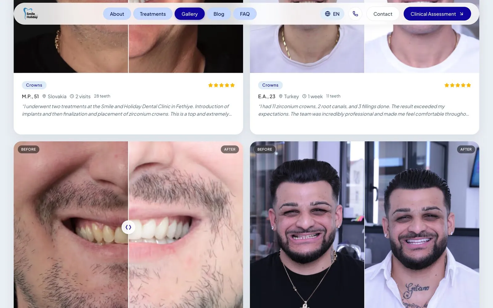 Before and after gallery: a real case archive filtered by treatment type.